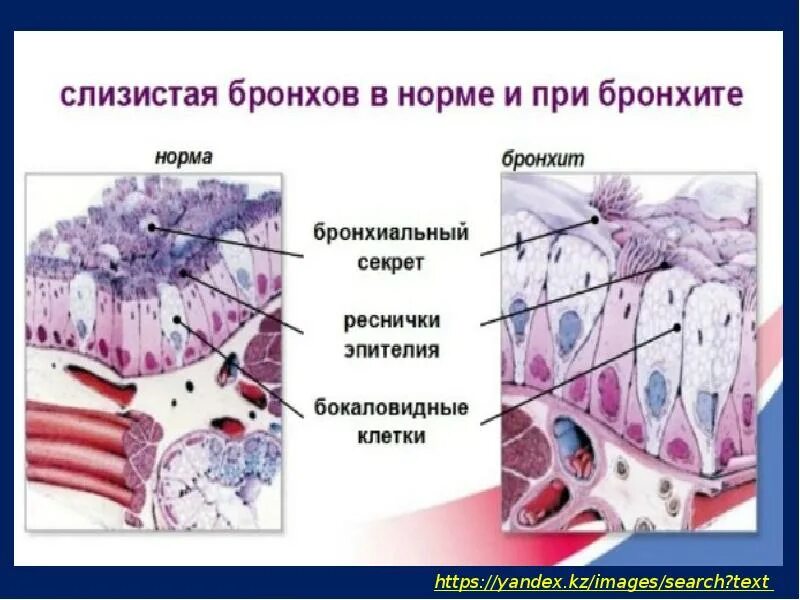 Слизистые клетки секрет. Строение слизистой оболочки бронхов. Покровный эпителий бронха. Бокаловидные клетки эпителия бронхов. Строение слизистой бронха.