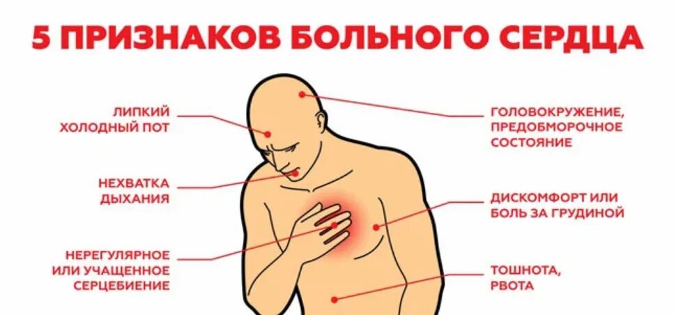 Болит сердце отдает в руку. Боли в области сердца. почему болит сердце. боль в сердце симптомы. если болит сердце симптомы.