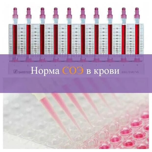 Соэ в крови 20. СОЭ. Скорость оседания эритроцитов по Панченкову. СОЭ В крови по Панченкову. СОЭ У мужчин норма по методу Панченкова.