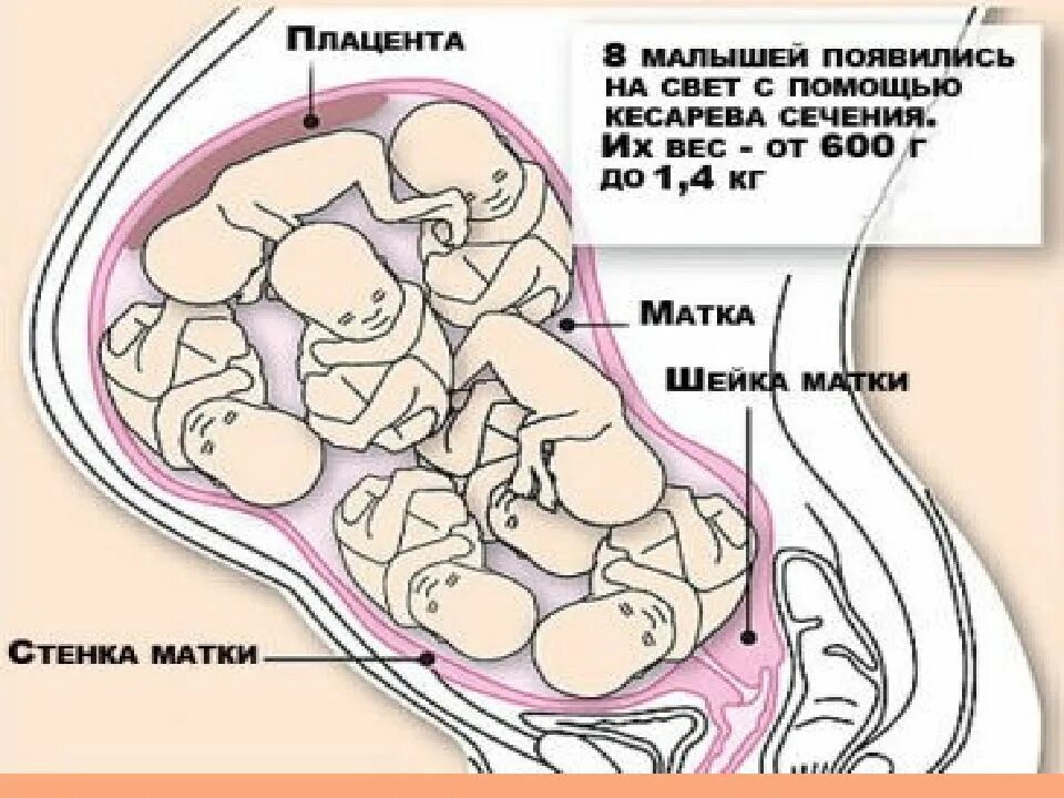 Где располагается беременность