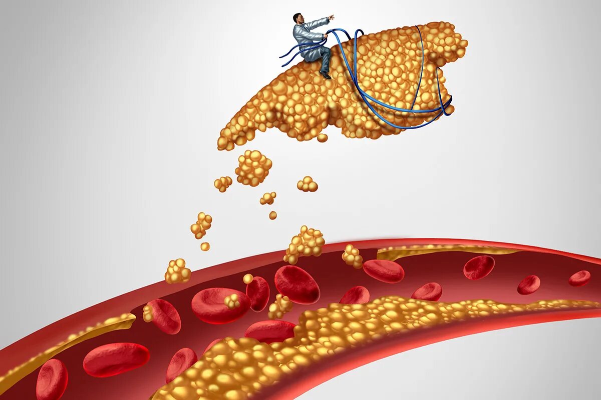 Холестерин. Холестерин рисунок. Холестерин фото. Холестерин фон.