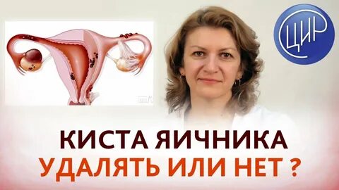 Что можно есть после операции удаление кисты