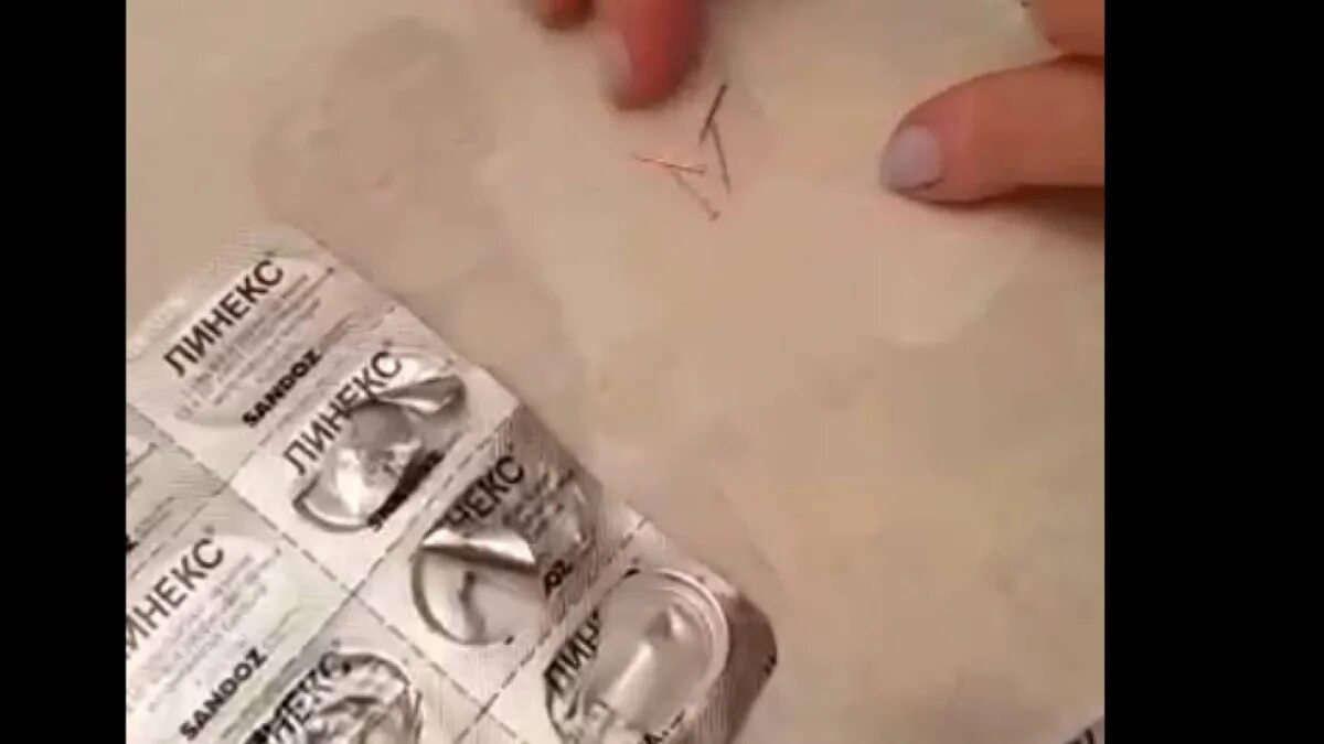 Извлечь клеща пластиковой картой. Как открыть капсулу таблетки. Эндоскопия достать инородное тело. Mi band скрытая камера. Как поменять инсулин в ручке.