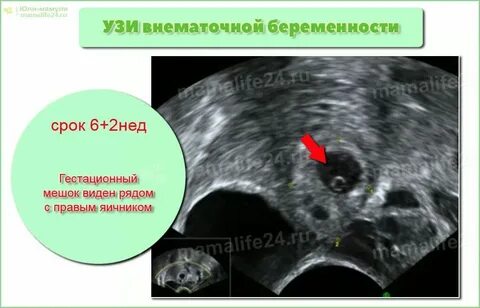 Яичник зародыш
