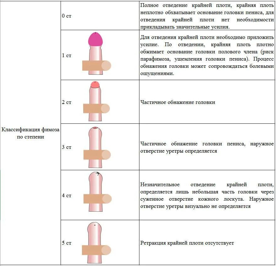 Симптомы и признаки урологических заболеваний