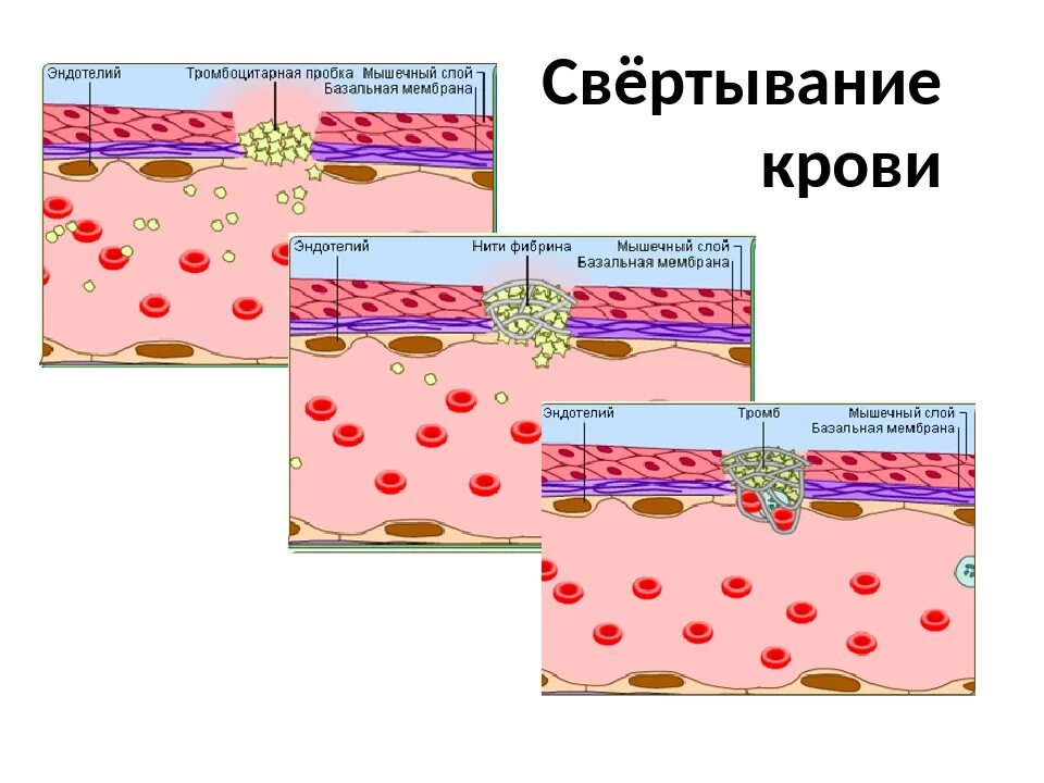 Почему плохая свертываемость крови. Нарушение системы свертывания крови. Врожденные нарушения свертывания крови. Синдром нарушения свертываемости крови. Быстрое свертывание крови.