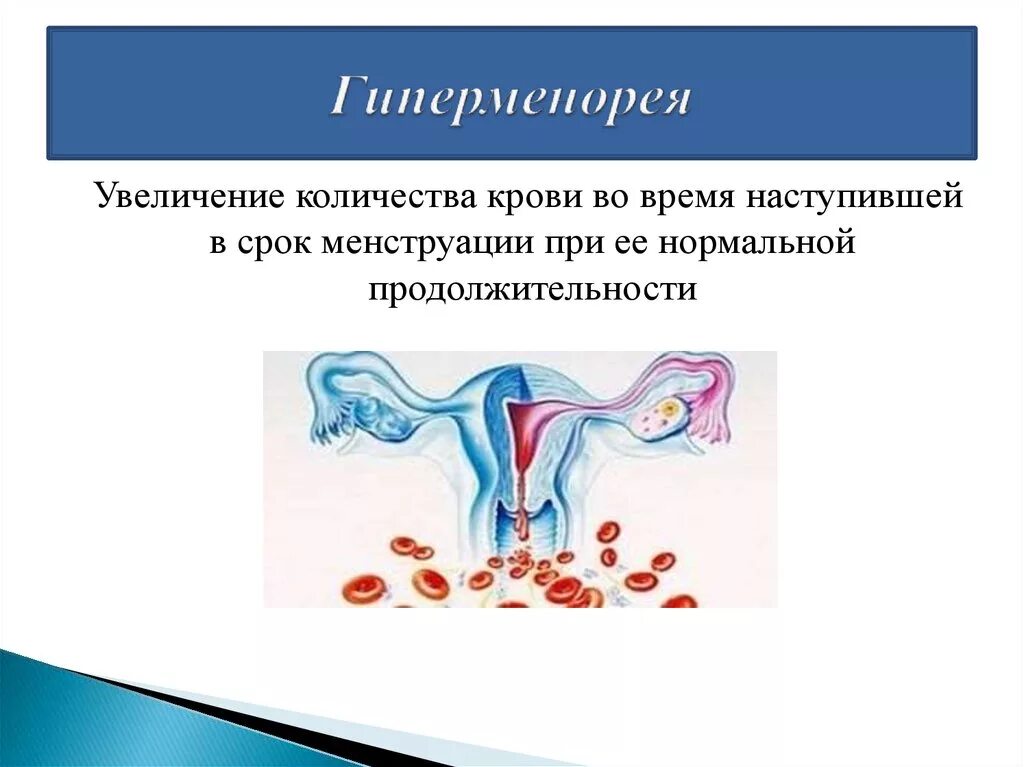 Причины крови во время акта. Гиперменорея. Менструационного цикла. Сколько крови при менструации. Гиперменструальный синдром.