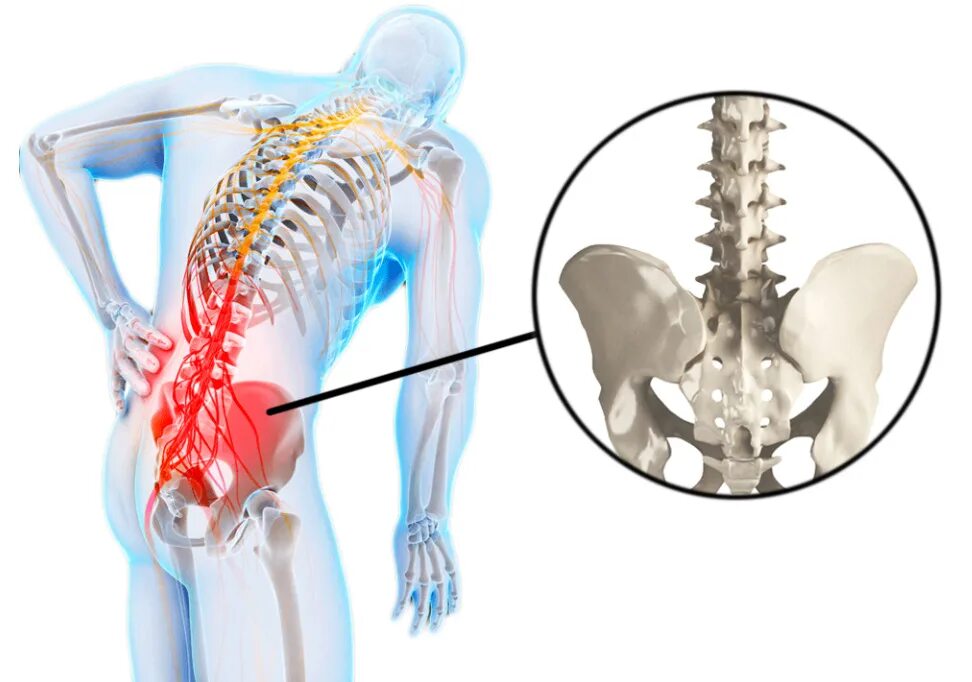 Как болит поясница симптомы. Пояснично-крестцовый отдел позвоночника. Люмбаго поясничного отдела позвоночника симптомы. Поясцово-крестцовый отдел позвоночника. Люмбалгия поясничного крестцового отдела.