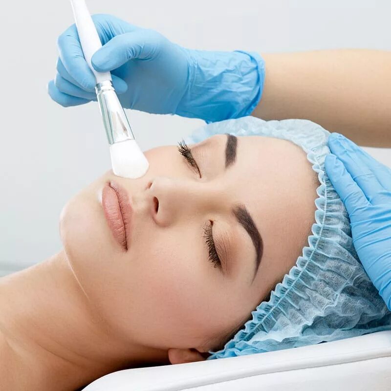 Хим пилинг. Химический пилинг. Пилинг лица у косметолога. Хим пилинг. Пилинг для лица.