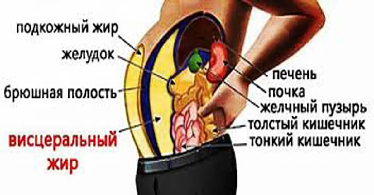 Висцеральный жир продукты. Подкожный и висцеральный жир. внутренний висцеральный жир. висцеральный жир на органах.