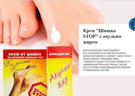 Лечение шишек стопы