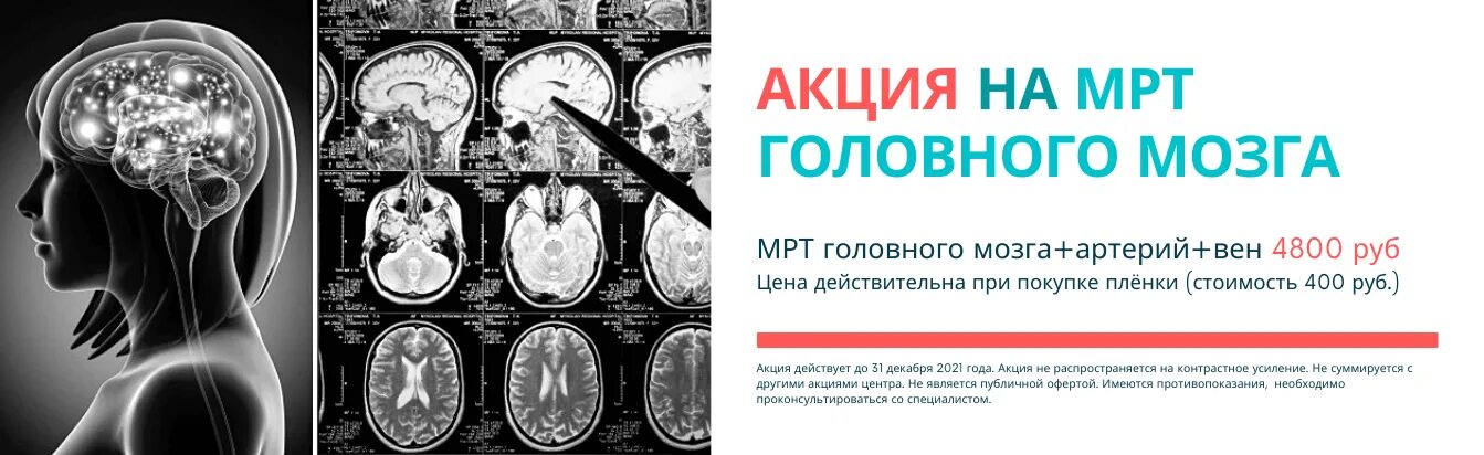 Мозга нижний тагил. Мрт головного мозга в Калуге. Акция мрт. Мрт головного мозга акция. Мрт головы акция.