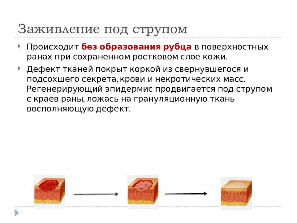 Через сколько заживает рана. Заживление РАН под струпом. Рана, заживающая под струпом. Ускорение процесса заживления раны. Заживление происходит под струпом.