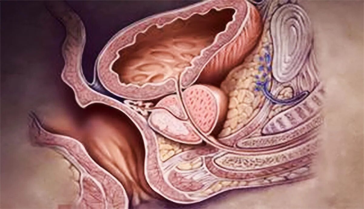 Предстательная железа, Prostata. Семенной бугорок предстательной железы. Простата железа у мужчин. Красивая простата