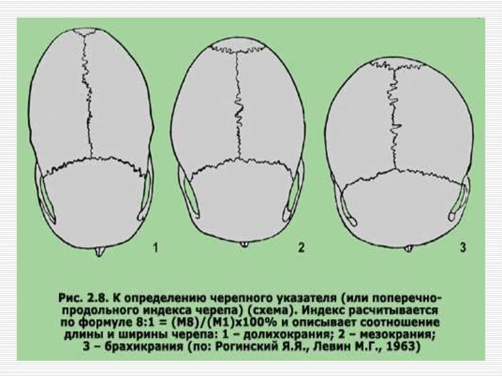 Варианты формы черепа. Форма черепа. Мезокранная форма черепа. Долихокранная форма черепа. Формы черепа классификация.