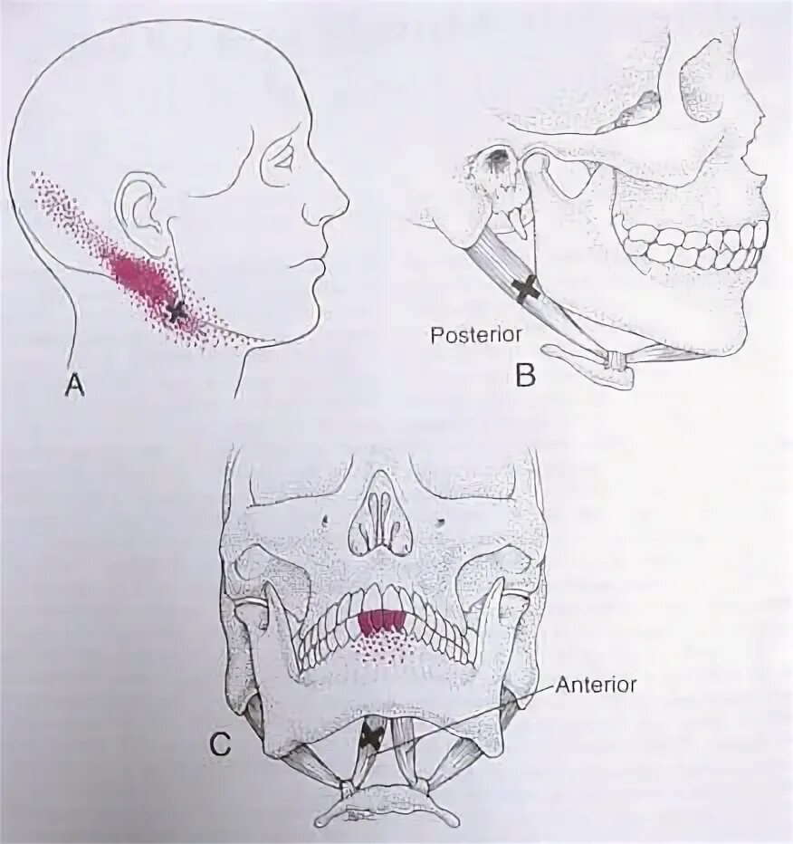 Боль в челюсти. Боль в кости нижней челюсти. Боль в нижней челюсти при нажатии.