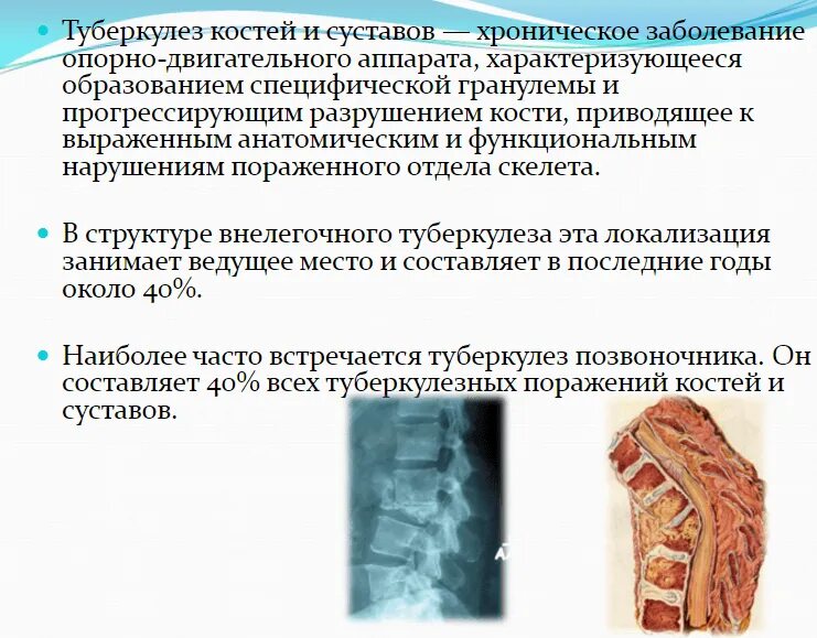 Туберкулез ноги. Туберкулёз костей симптомы. Туберкулез костей и суставов. Туберкулез костей и суставов туберкулёзный спондилит. Костно-суставной туберкулез позвоночника.