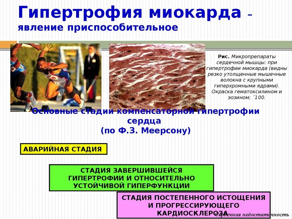 Гиперфункция сердца