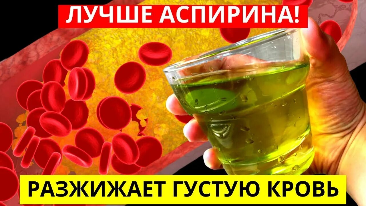 Как пить аспирин для крови. Густая кровь разжижение,,,,,. Аспирин приразжижегии крови. Аспирин разжижает кровь. Аспирин для разжижения крови.