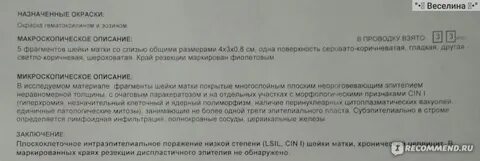 Операция шейки матки отзывы
