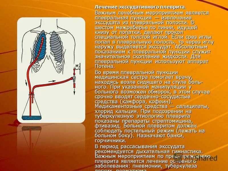Плеврит лечение у пожилых. Экссудативный плеврит терапия. лекарства при сухом плеврите. лекарственная терапия при экссудативном плеврите.