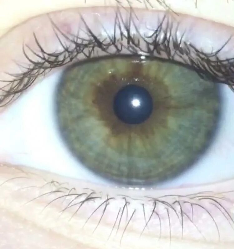 Один глаз серый другой. Центральная гетерохромия карих глаз. Центральная гетерохромия зеленый Карий. Центральная гетерохромия глаз Карий и зеленый. Центральная гетерохромия голубой Карий зелёный.