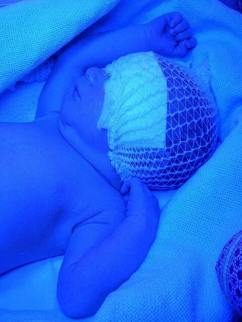 УФ лампа для желтушки новорожденного. УФ лампа для новорожденных с желтушкой. УФ лампа для фототерапии новорожденных. Led лампа от желтушки.