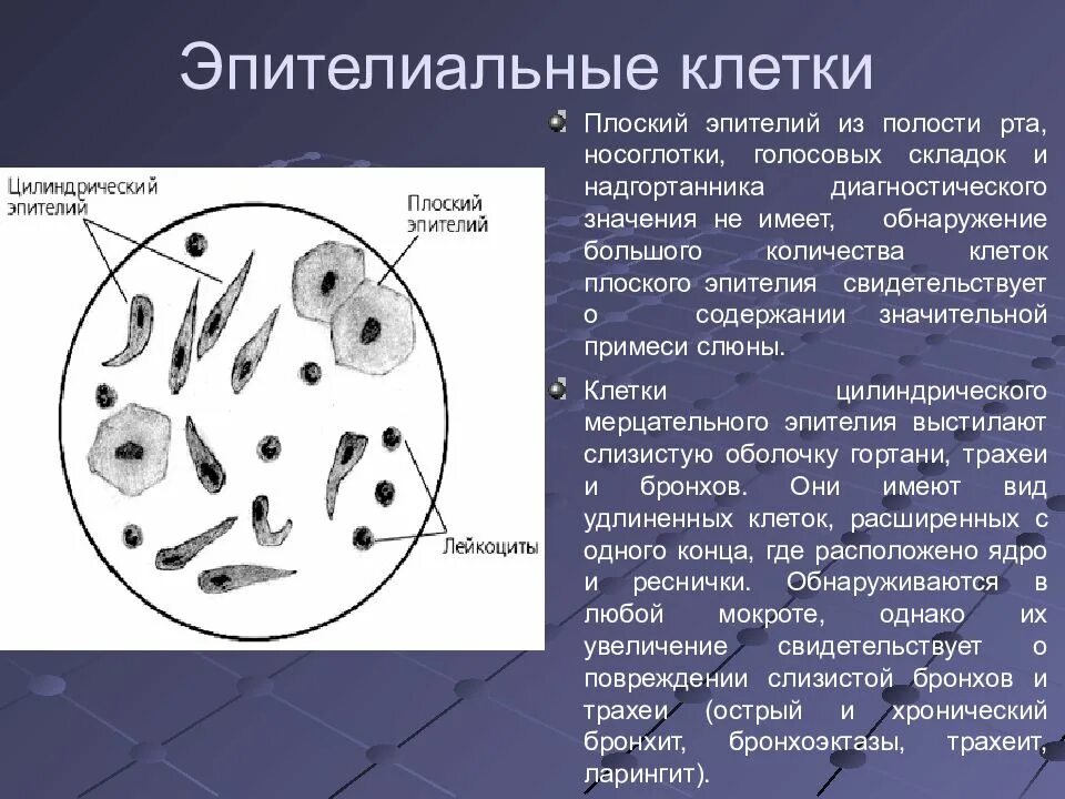 Элементы мокроты. Эпителиальные клетки в мокроте. Клетки плоского эпителия в мокроте. Цилиндрический эпителий в мокроте. Цитологическое исследование мокроты.