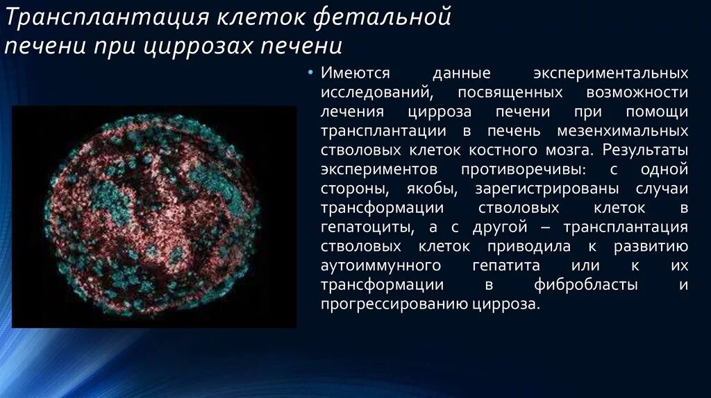 Количество клеток печени. Трансплантация фетальных гепатоцитов. Трансплантация фетальных клеток. Трансплантация клеток фетальной печени при циррозах печени. Понятие о стволовых клетках печени.