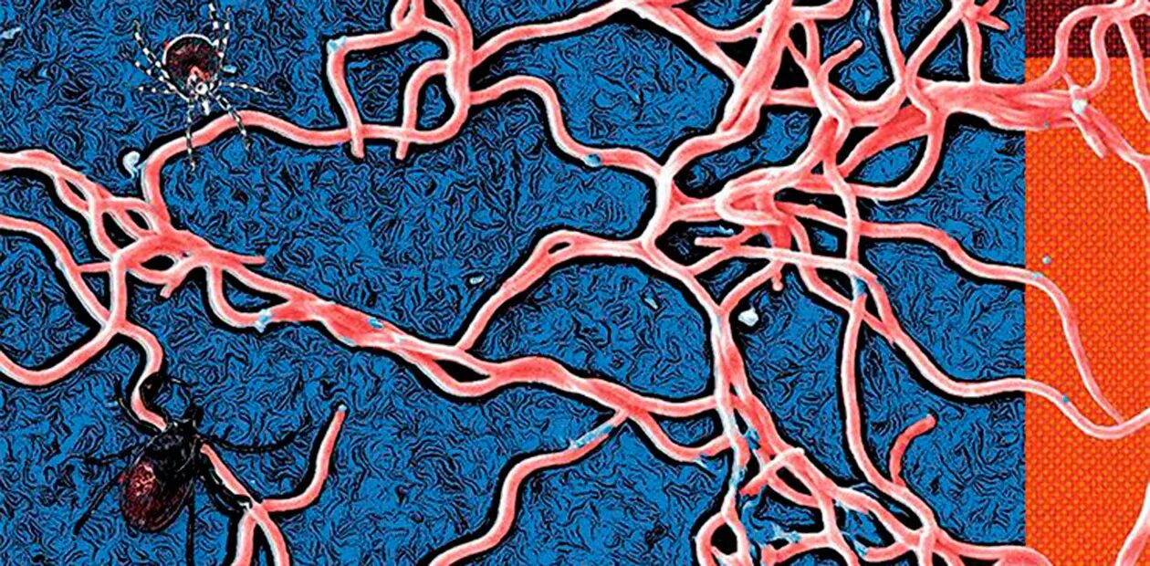 Спирохеты боррелии. Боррелиоз burgdorferi. Borrelia recurrentis микробиология. Клинические проявления 1 стадии боррелиоза. Боррелиоз burgdorferi.