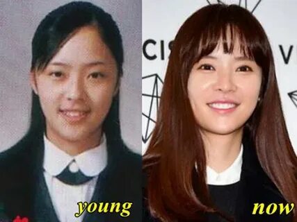 Hwang jung eum plastic surgery online
