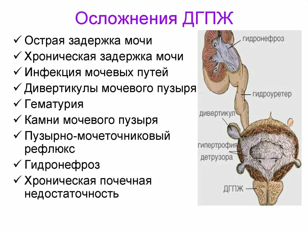 Простатит дгпж