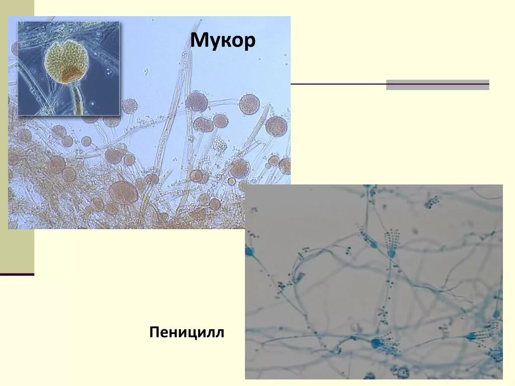 Строение плесневых грибов мукора и пеницилла. Мукор микроскопирование. Строение мукора и пеницилла. Гриб мукор и пеницилл. Чем строение пеницилла отличается от строения хлебных