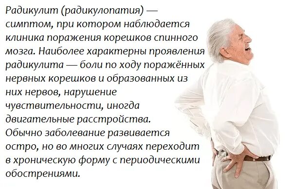 Сколько радикулит
