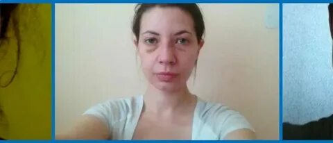 Почему держится отек