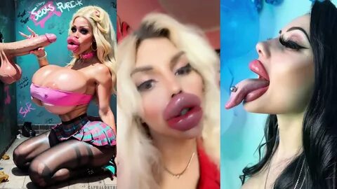 Slideshow huge bimbo lips.