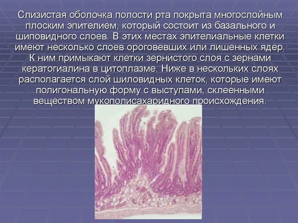 Слизистая оболочка полости рта строение. Слизистая оболочка ротовой полости гистология. Слизистая полости рта гистология. Гистология слизистой ротовой полости. Клетки слизистой полости рта