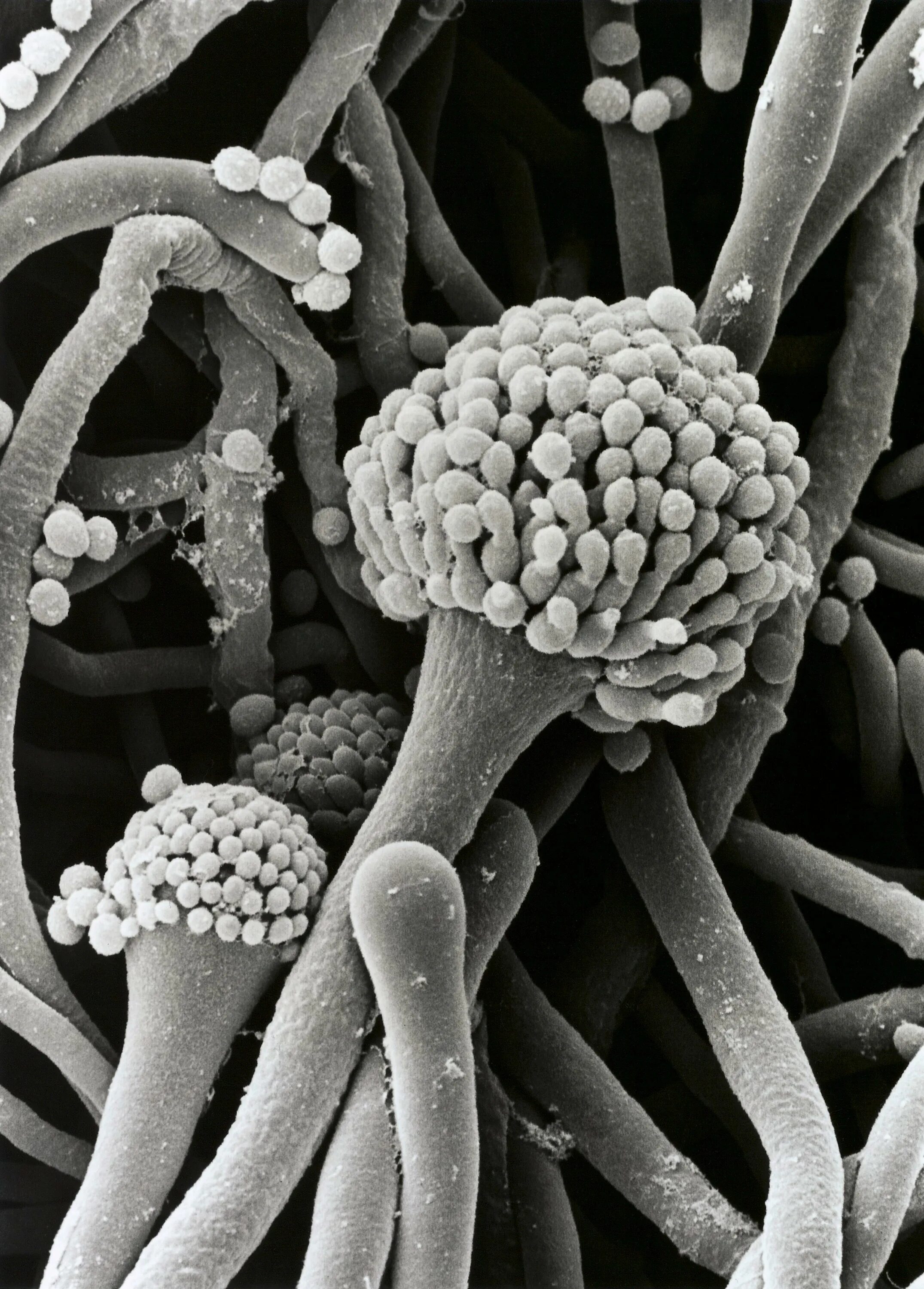 Аспергилл кандида. Плесневые грибы аспергилл. Гифомицеты Aspergillus. Микромицеты аспергилл. Грибы споры в организме