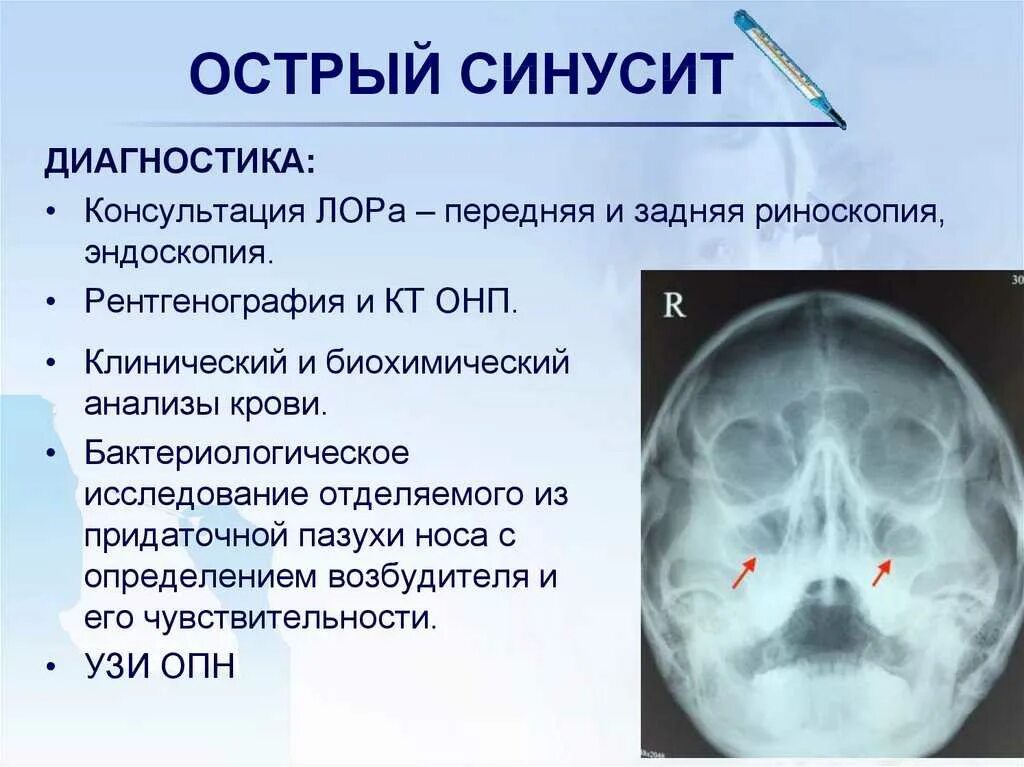 Синусит это что такое простыми словами