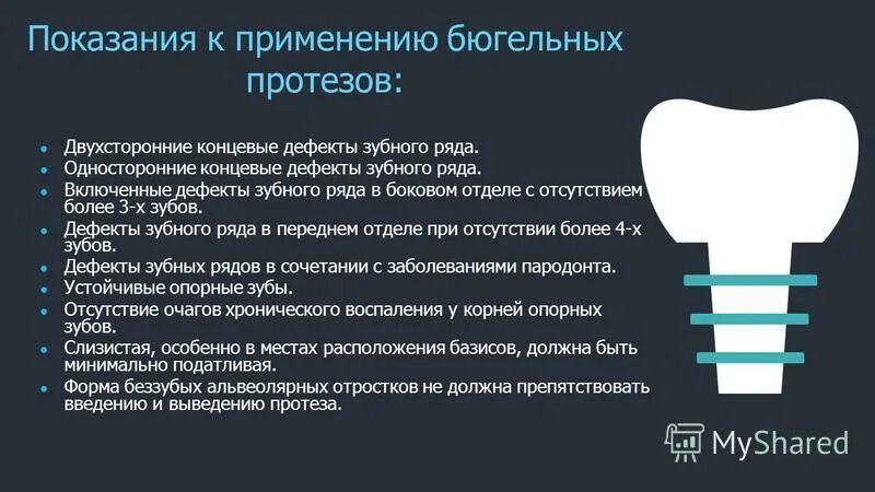 Преимущества и недостатки бюгельных протезов. Преимущества и недостатки бюгельных протезов