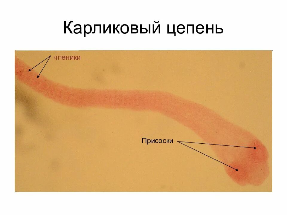 Карликовый цепень препарат. Карликовый цепень строение препарат. Карликовый цепень Тотальный препарат. Карликовый цепень членик. Карликовый цепень строение