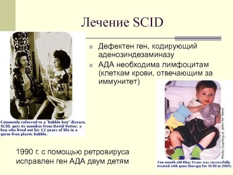 Дефектный ген что это такое. Тяжелый комбинированный иммунодефицит scid. ТКИД С дефектом аденозиндезаминазы. Врождённая недостаточность аденозиндезаминазы (ада-ткин). Ген аденозиндезаминазы.