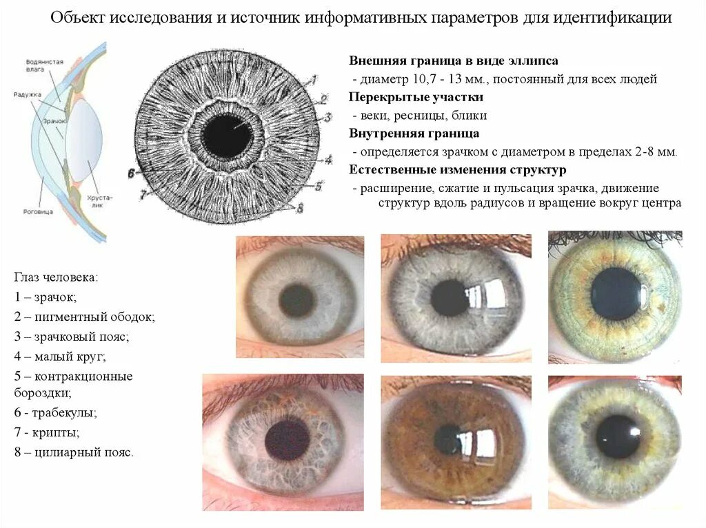 Иридодиагностика радужной оболочки глаза. Ободок вокруг Радужки. Темный ободок вокруг Радужки. Кайма вокруг Радужки глаза.