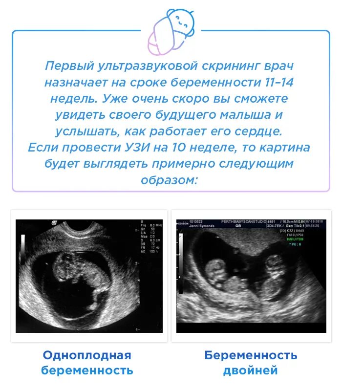 УЗИ на 10 акушерской неделе беременности. Эмбрион на 10 неделе беременности УЗИ. УЗИ на 11 акушерской неделе беременности. УЗИ плода на 10 акушерской неделе. Разница акушерской недели и