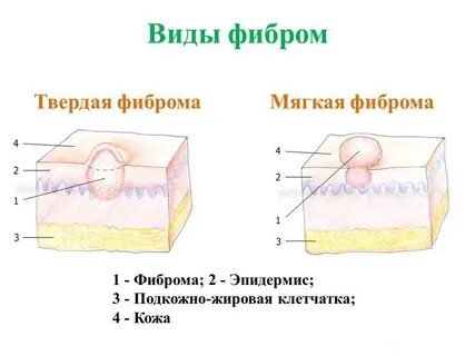 Твердо кож