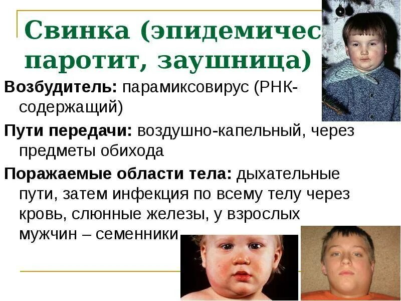 Свинка симптомы у взрослых у женщины. Характерный клинический симптом эпидемического паротита. Основные клинические симптомы эпидемического паротита. Свинка эпидемический паротит. Эпид паротит пути передачи.