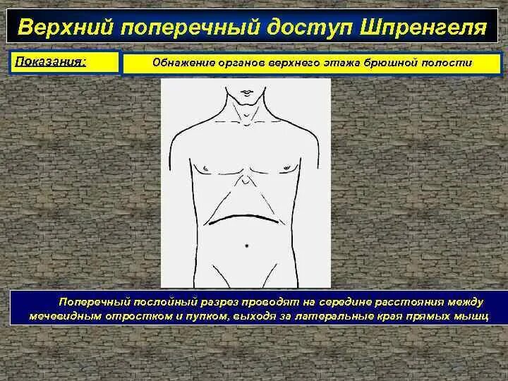 Поперечной информации
