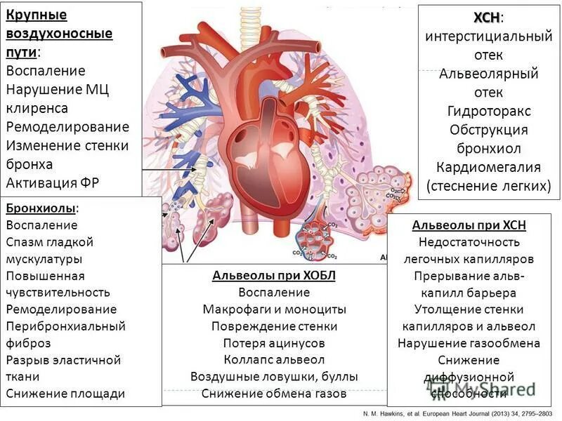 Легкие сердечные заболевания. Хроническое заболевание легких ХОБЛ. При хронической обструктивной болезни легких. Хроническая обструктивная болезнь лёгких этиология.