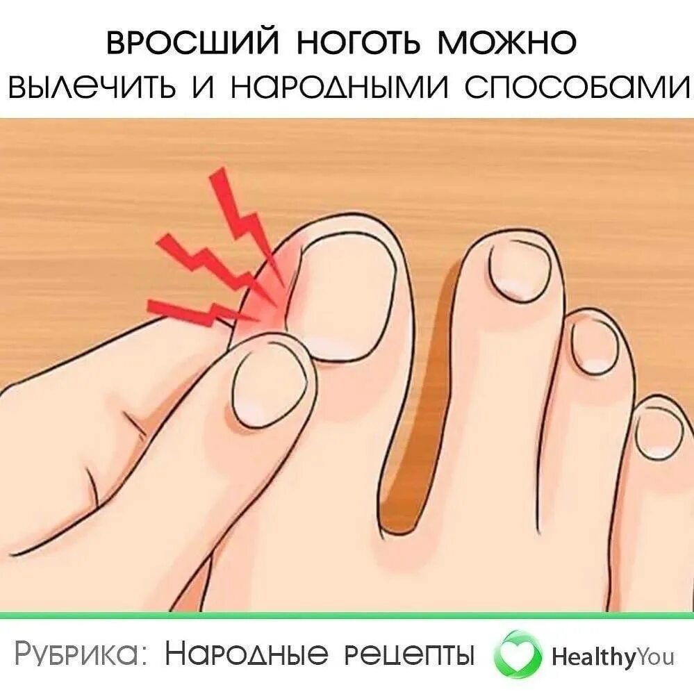 Как подстригать ногти на большом пальце