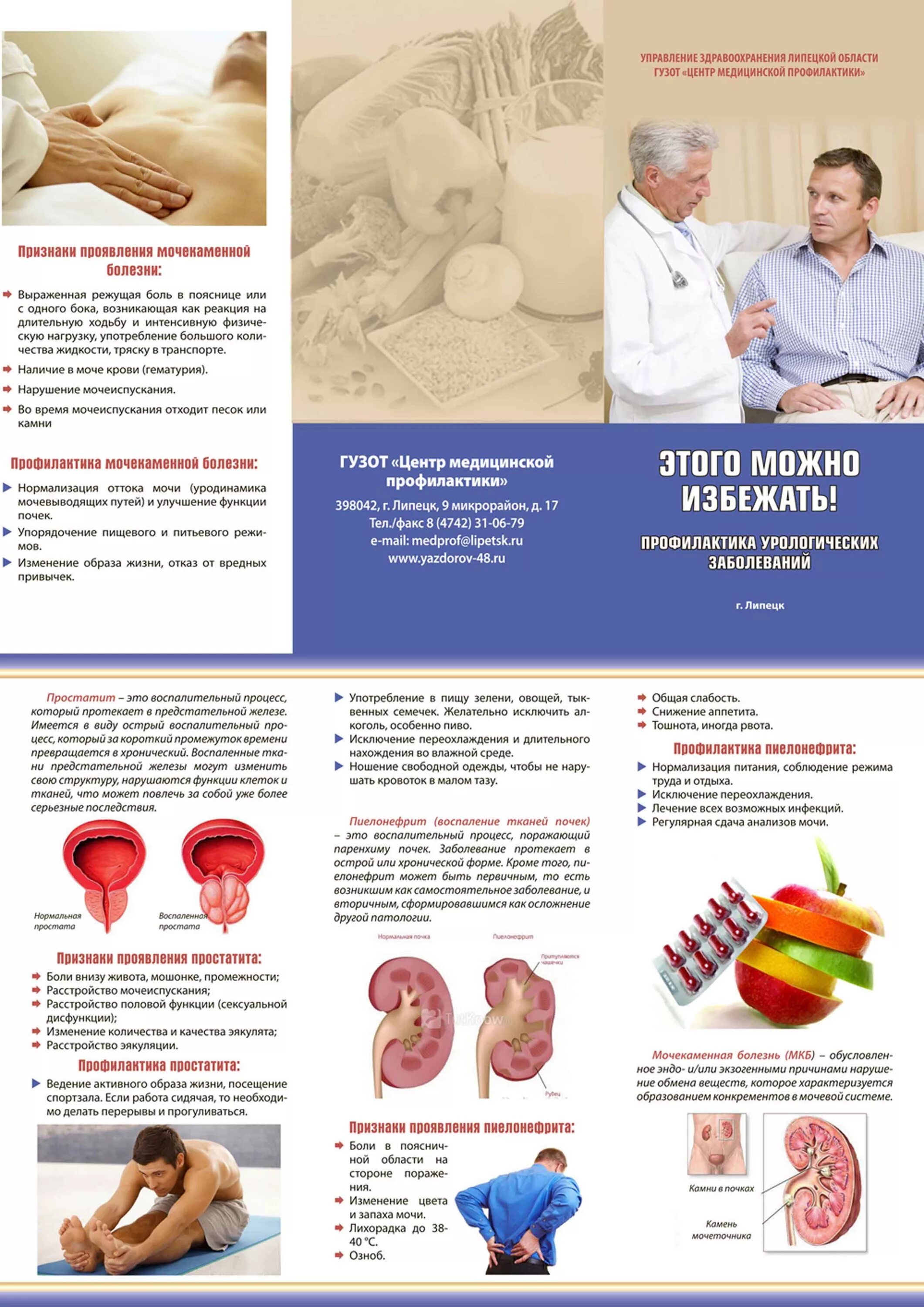 Мочекаменная болезнь профилактика заболевания. Профилактика мочекаменной болезни брошюра. Санбюллетень мочекаменная болезнь. Буклет по профилактике мочекаменной болезни. Мочекаменная болезнььпрофилактика.